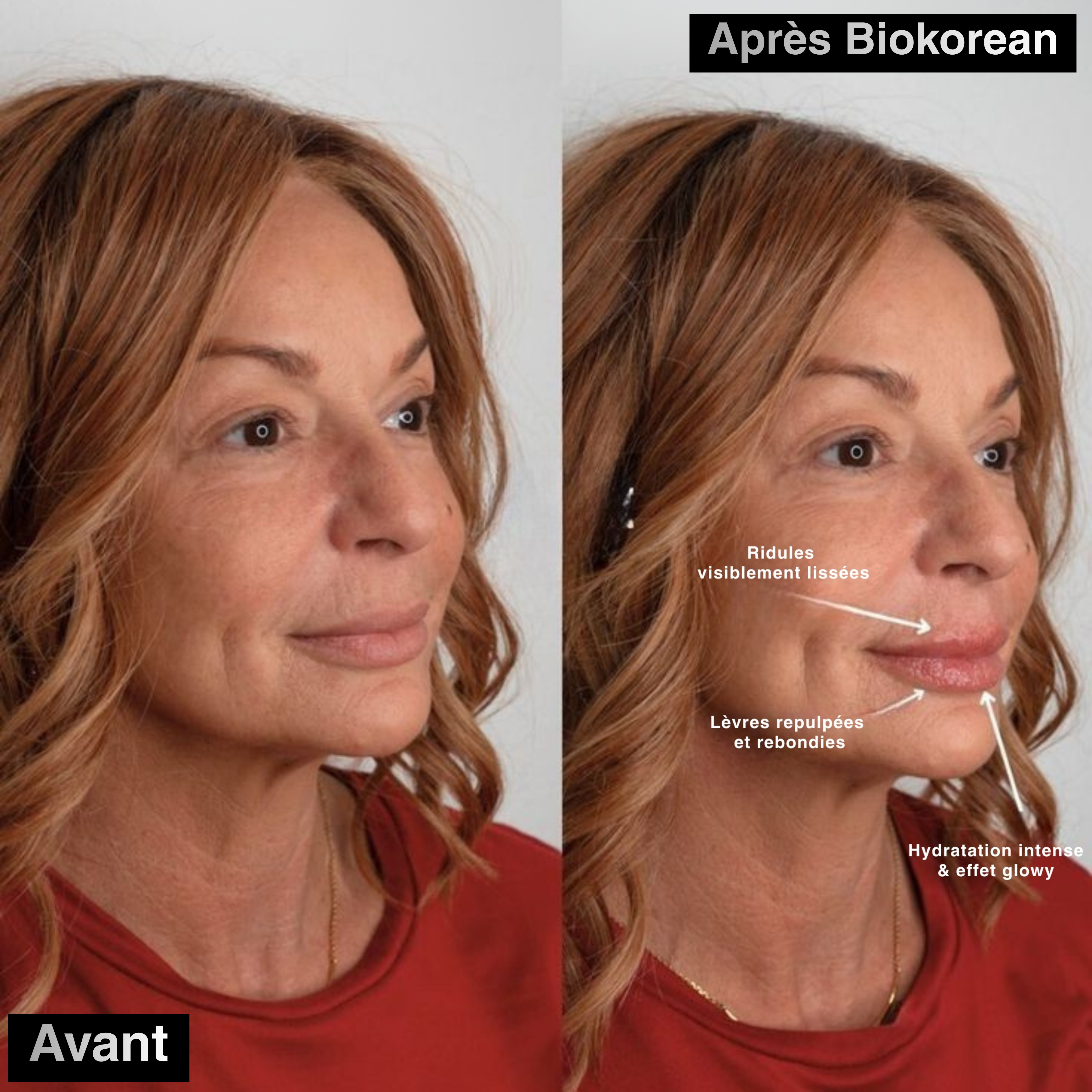 3 PATCHS AU BIO-COLLAGÈNE