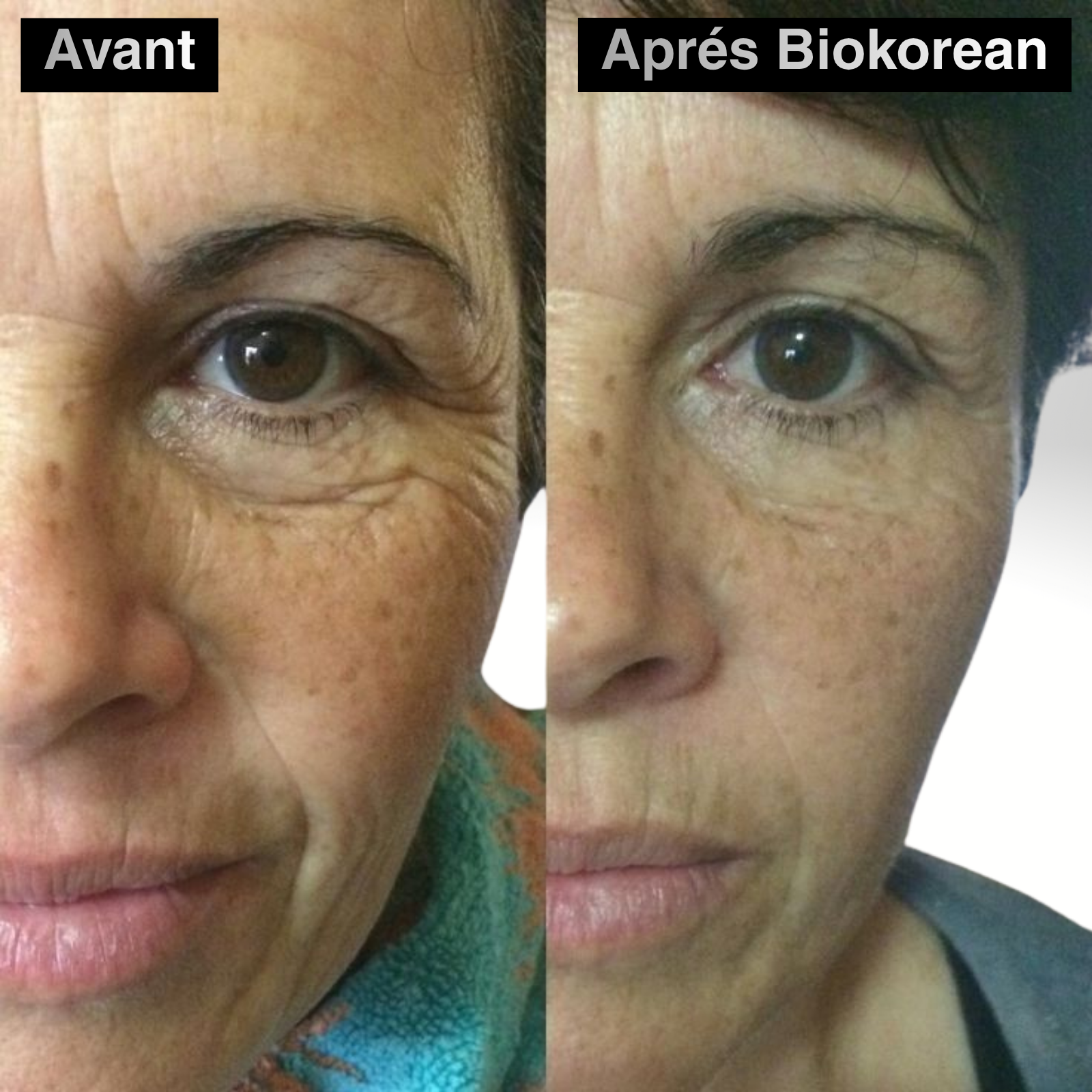 60 PATCH ALOE VERA & COLLAGÈNE YEUX