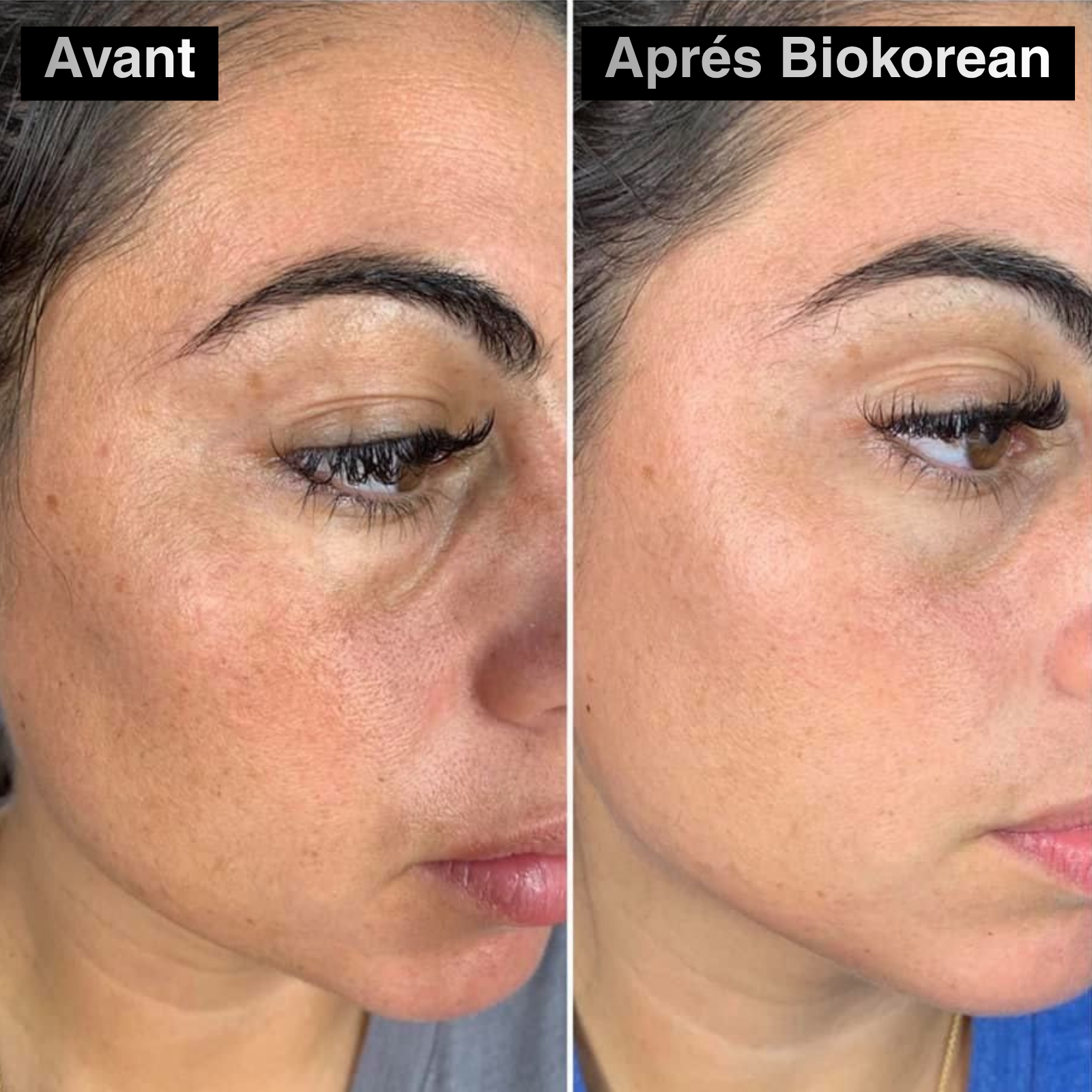 60 PATCH ALOE VERA & COLLAGÈNE YEUX