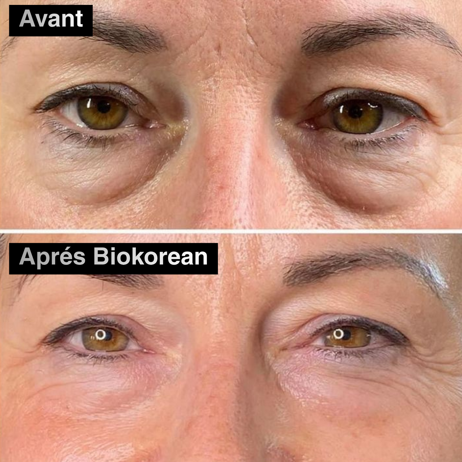 60 PATCH ALOE VERA & COLLAGÈNE YEUX