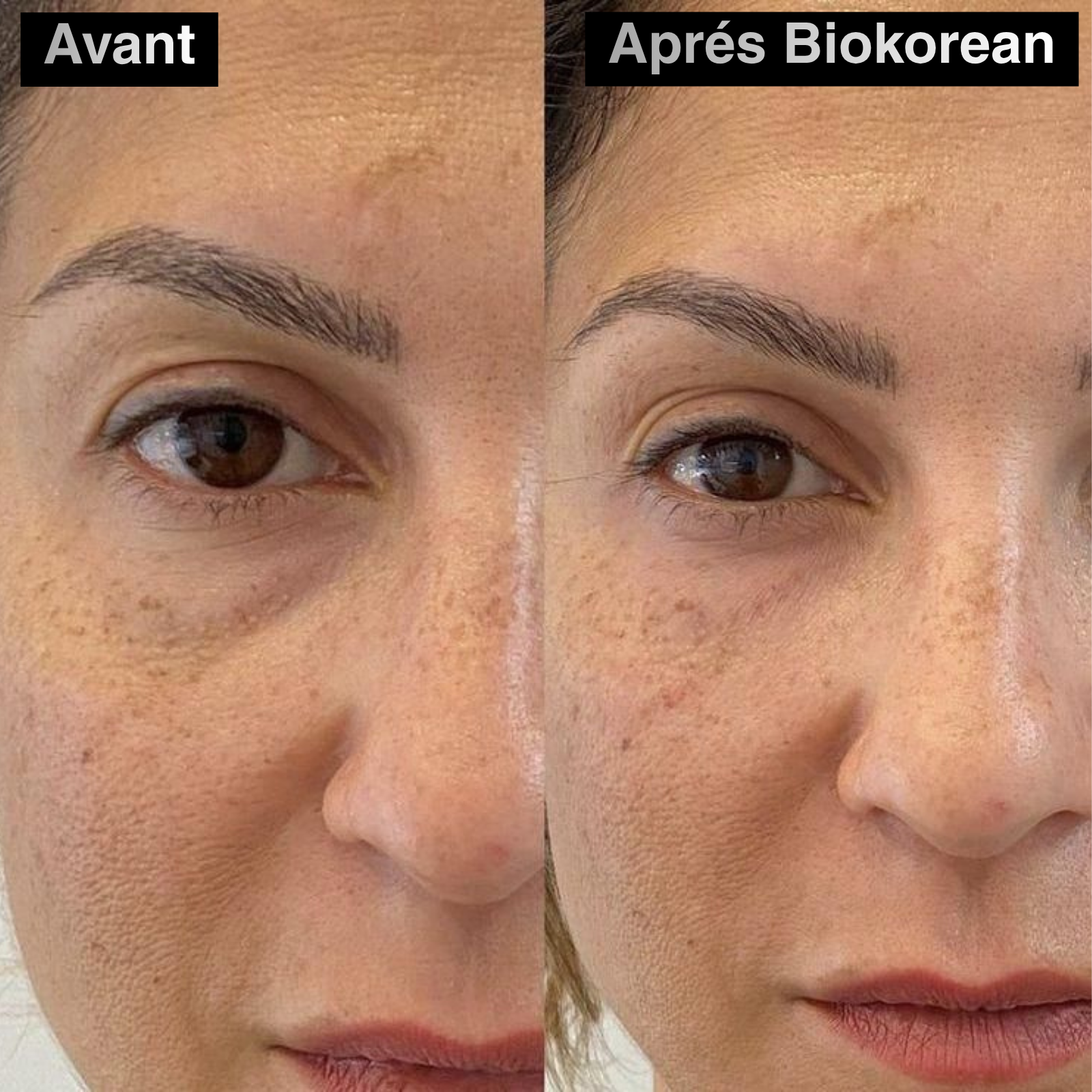 60 PATCH ALOE VERA & COLLAGÈNE YEUX