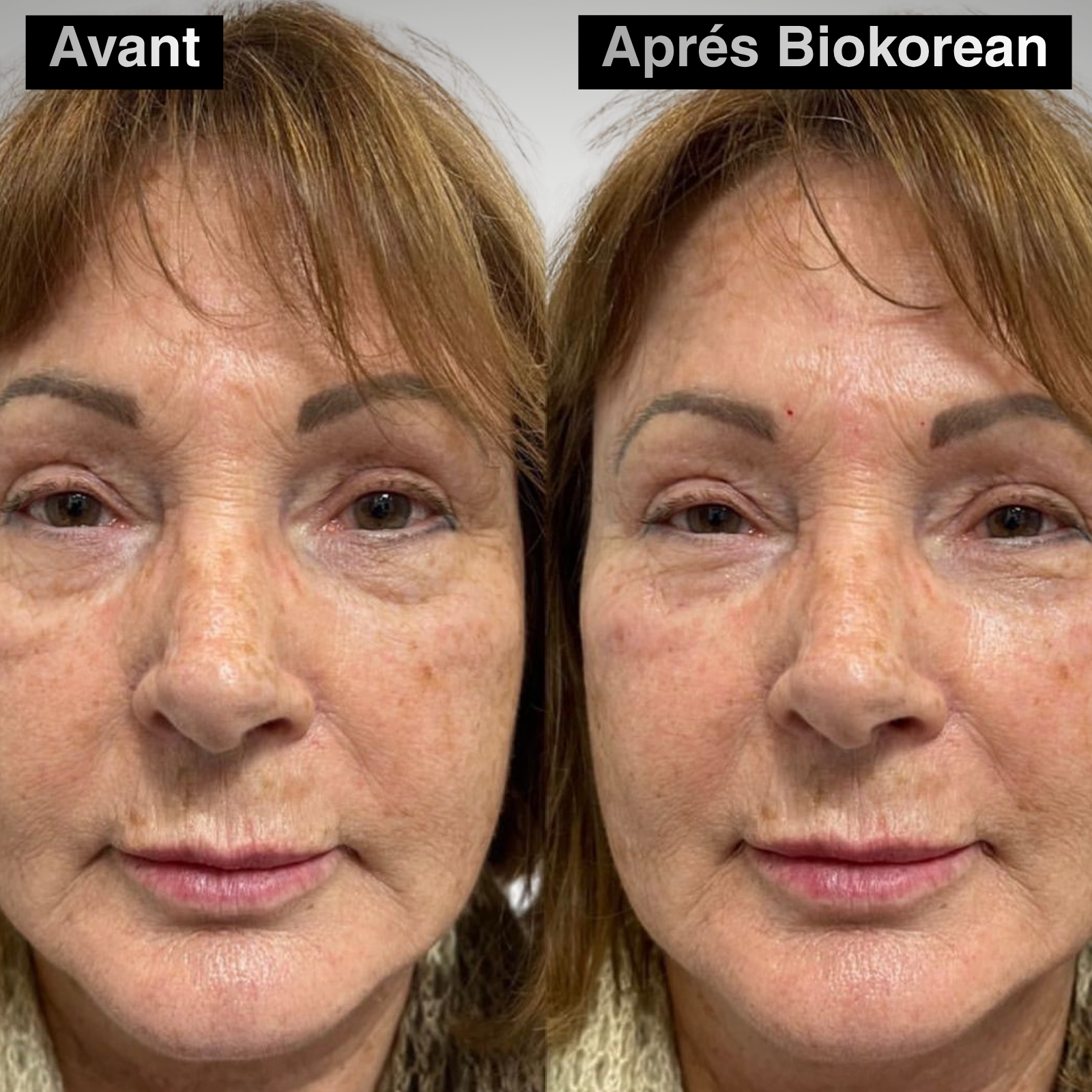 60 PATCH ALOE VERA & COLLAGÈNE YEUX